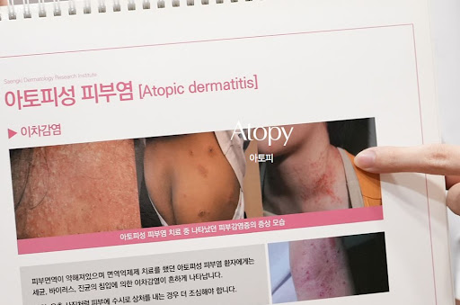 생기한의원이 설명하는 아토피 태선화 피부 변화의 의미